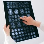 ct scan and mri scan difference private 2025