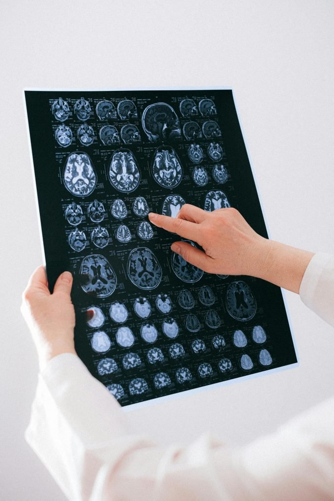 ct scan and mri scan difference private 2025
