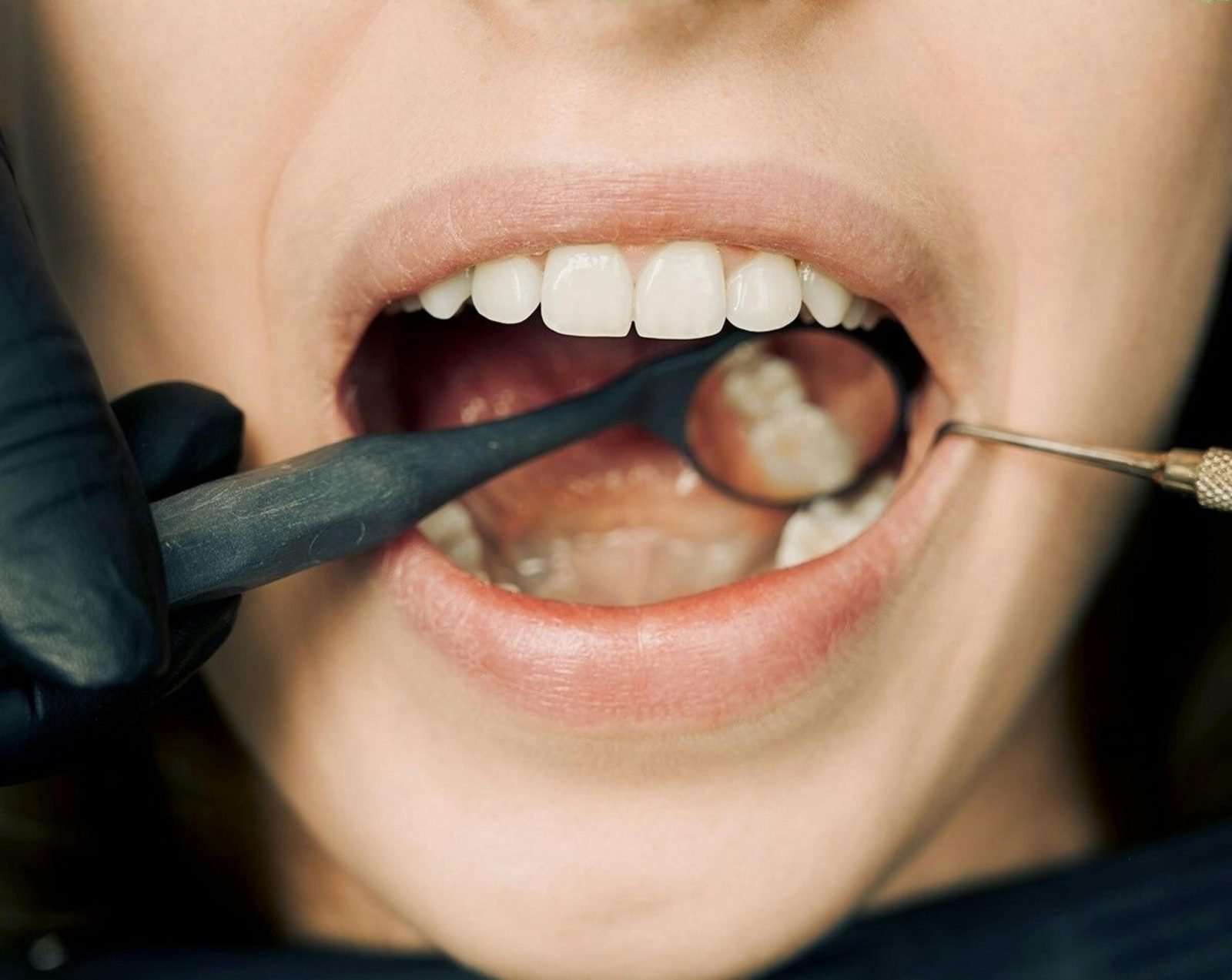 tonsillitis treatment private 2025