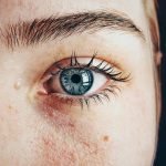 Patient undergoing laser eye surgery in a private UK clinic