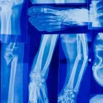 rivate x-ray scan in the UK – cost and what’s included