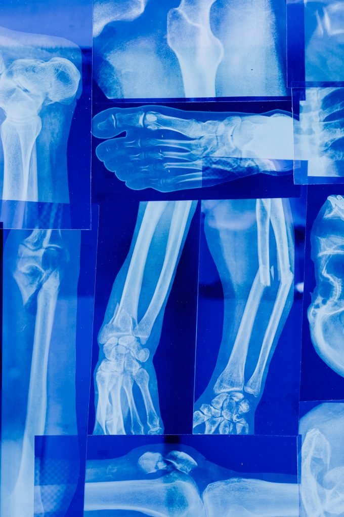 rivate x-ray scan in the UK – cost and what’s included