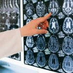 Private CT scan machine UK – 2025 cost breakdown