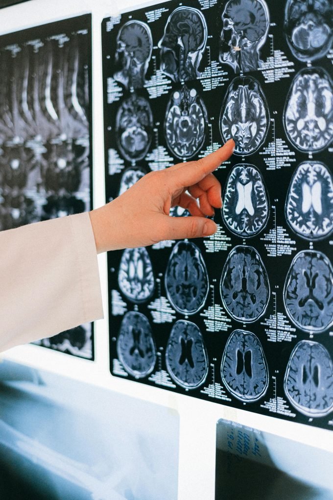 Private CT scan machine UK – 2025 cost breakdown
