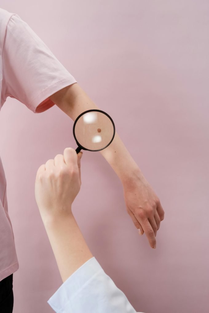 Dermatologist examining mole on patient's back in clinic