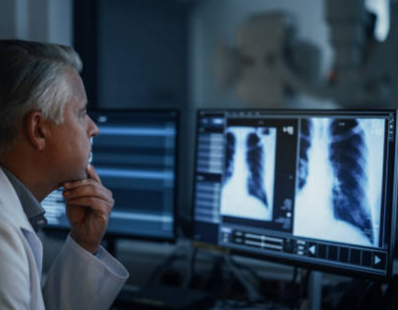 private lung function test doctor looking at results