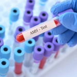 AHM Test 2025 blood test