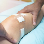 Private ACL Surgery in the UK