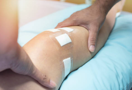 Private ACL Surgery in the UK
