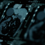 how are private scan report reviewed in the uk