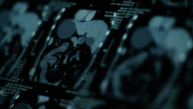 how are private scan report reviewed in the uk