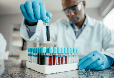 does health insurance cover routine blood test in the uk?