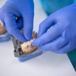 Private Dental Crowns UK (2025)