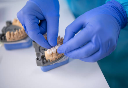 Private Dental Crowns UK (2025)