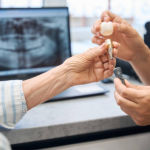 private dental implants in the uk, cost and guide