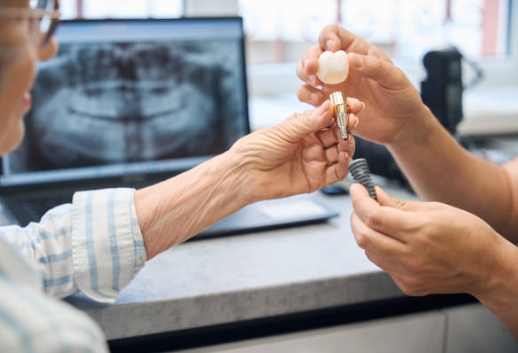 private dental implants in the uk, cost and guide