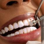 how much for teeth cleaning dentist uk
