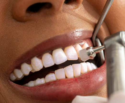 how much for teeth cleaning dentist uk