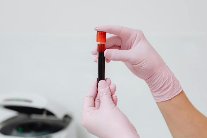 does axa cover blood tests