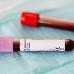 does bupa cover private blood tests for health insurance